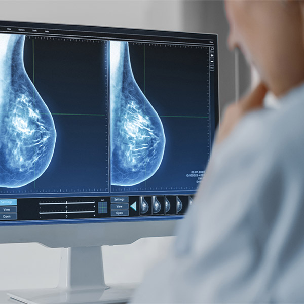 Breast Radiography